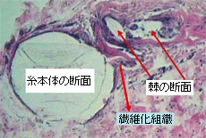 ̂鎅̎͂̑gD