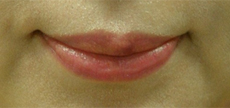 1MONTH AFTER